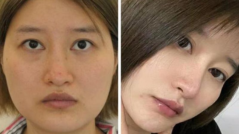 小标题：皮肤管理中心推荐的关键要素