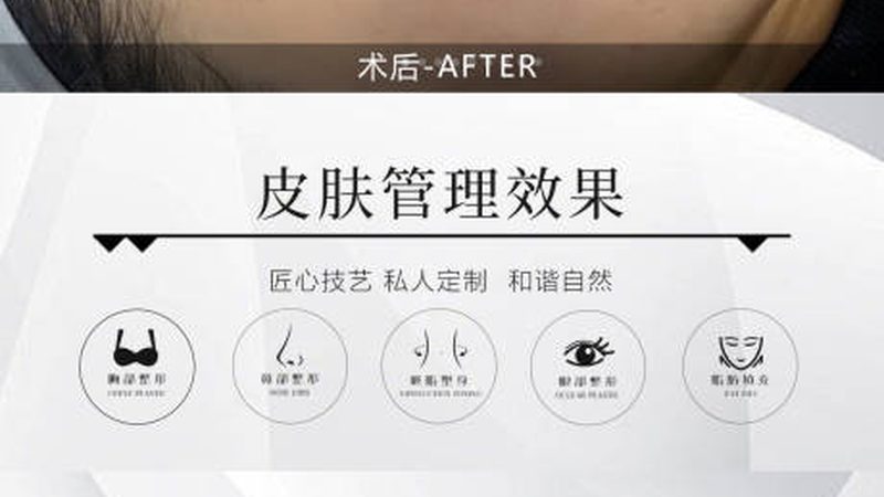 揭秘水光针代理加盟，了解这些关键点