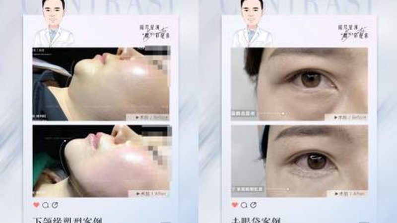 注射美容溶脂针：了解副作用，安全塑形