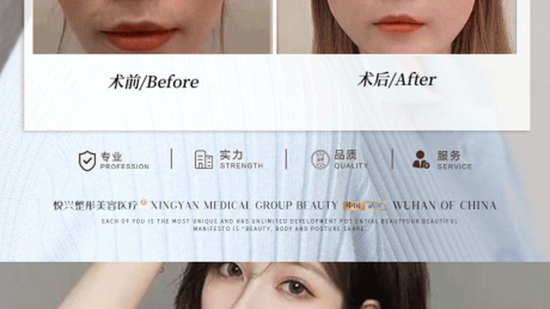 揭秘医美项目价格表：隐藏收费的真相