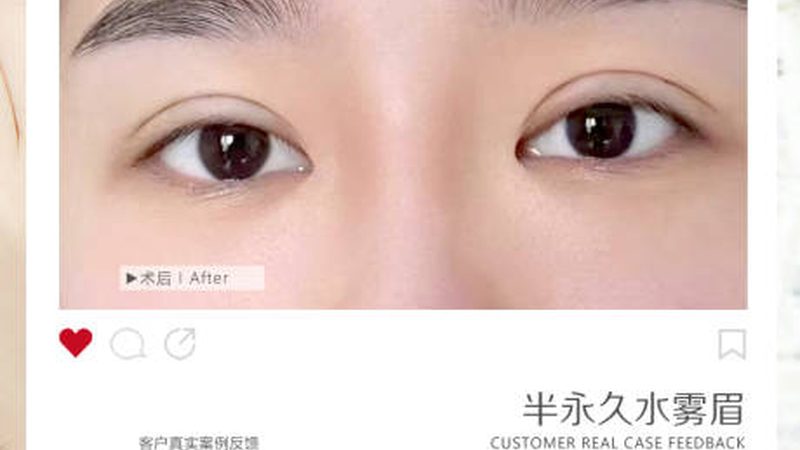 小型皮肤管理中心装修预算，如何精准把控？**