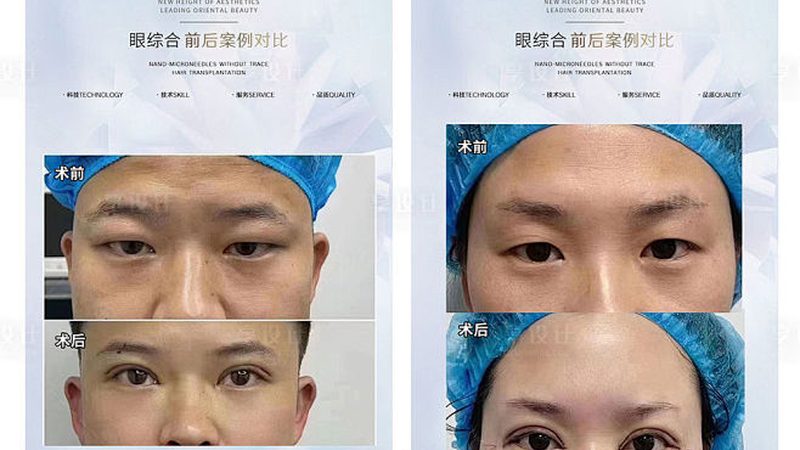 医美咨询师案例分享：如何从真实案例中传递专业与信任