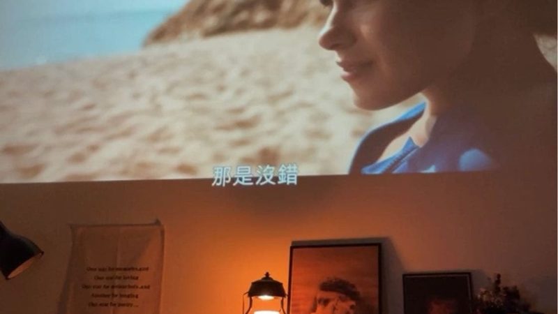 自体脂肪填充太阳穴：了解其优缺点，安全塑形有保障