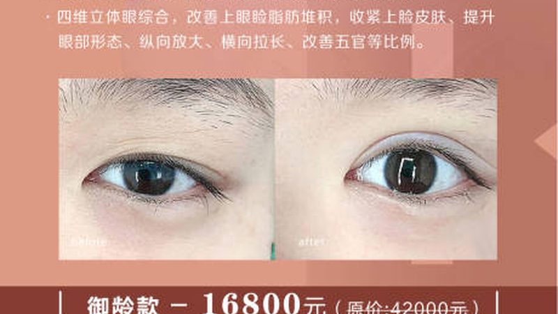 注射美容，如何选择适合自己的价格套餐？**