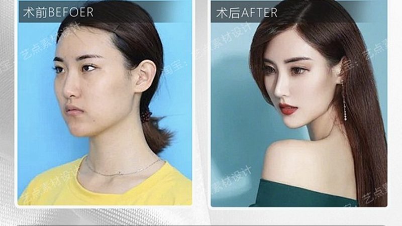 家用光子嫩肤仪：揭秘其原理与选购要点