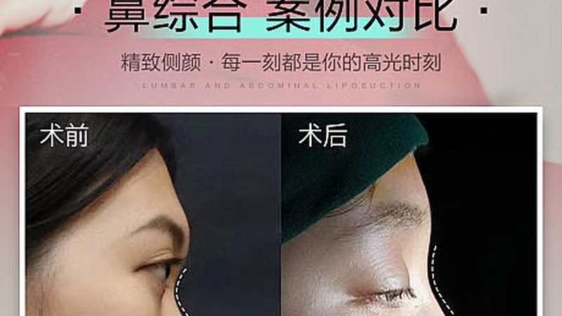 医用水光针：揭秘其批发价格背后的真相