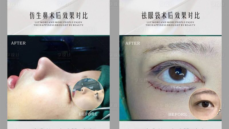 水光针注射，揭秘价格背后的秘密