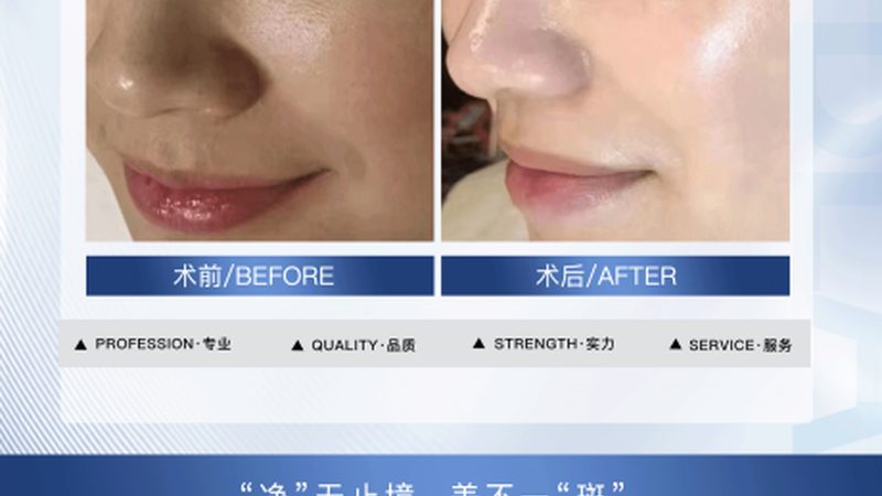 注射美容，哪些人群不宜尝试？**