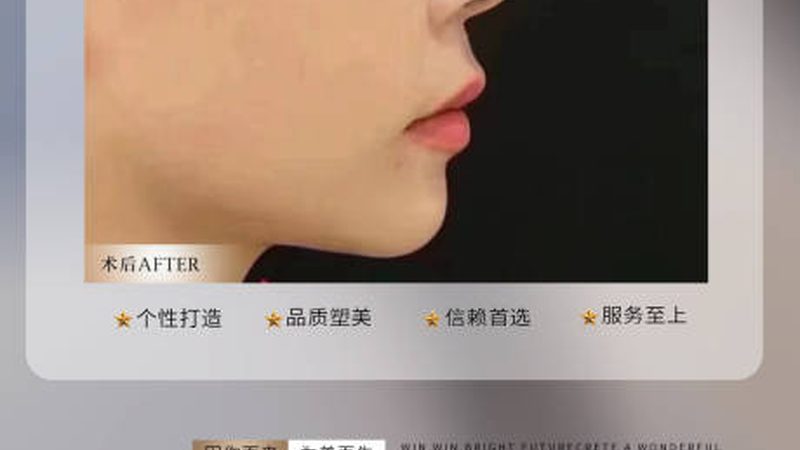 激光术后用医美面膜还是普通面膜