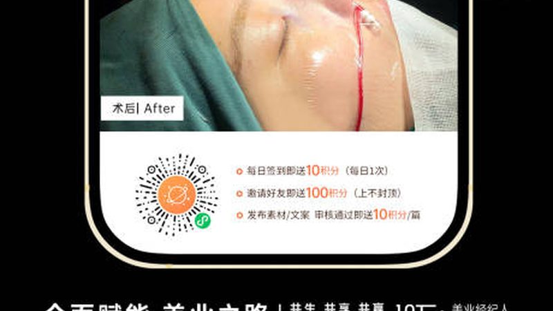 医用超声炮：揭秘其标准规范要求**