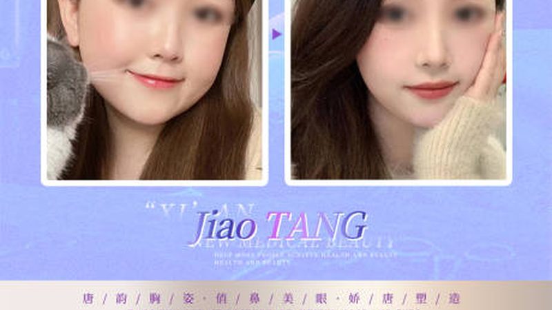 国产肉毒素去抬头纹，揭秘其原理与优势